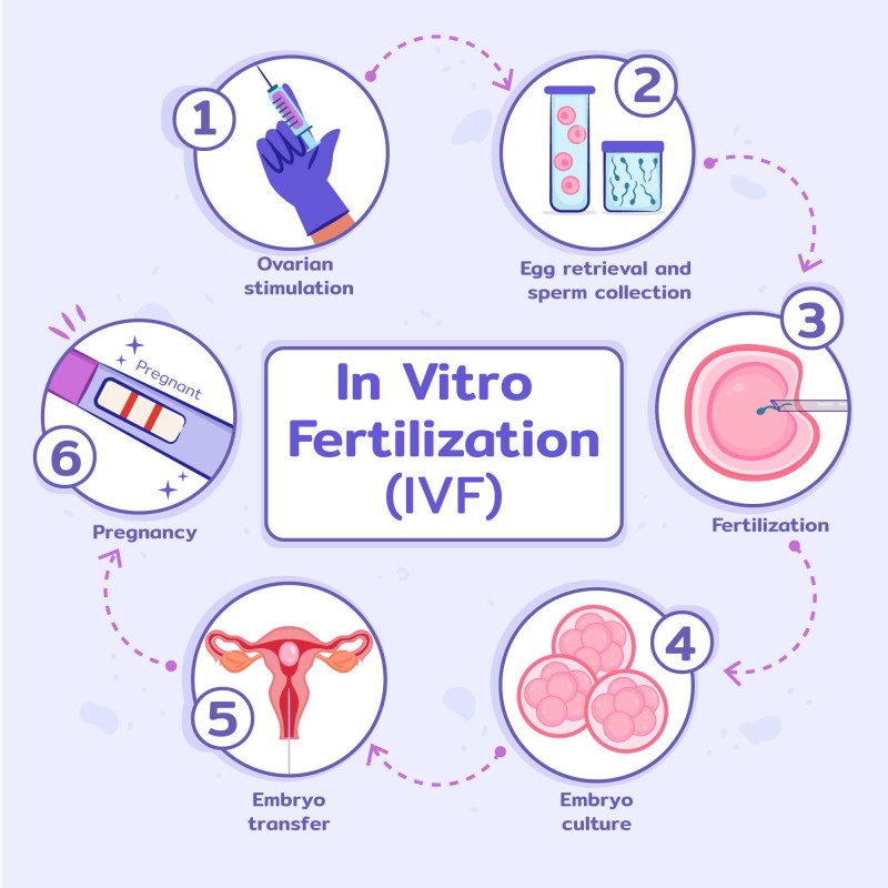 IVF Explained: What to Expect at Every Stage of the Journey